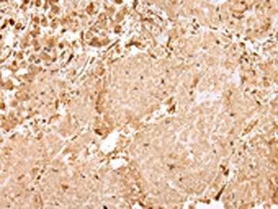 USP45 Antibody