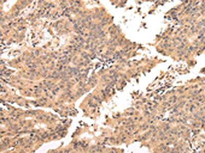 USP45 Antibody