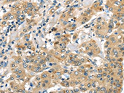 UTS2B Antibody