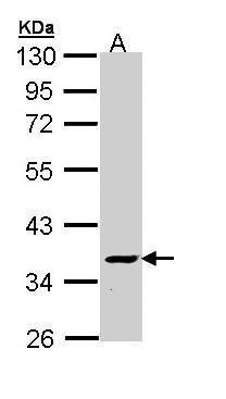 NUF2 Rabbit Polyclonal Antibody