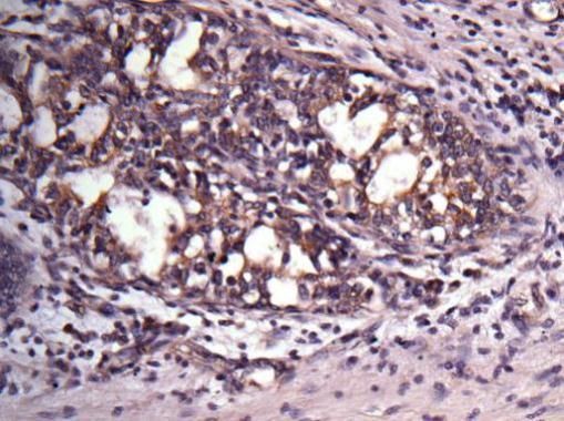 VAPA Rabbit Polyclonal Antibody