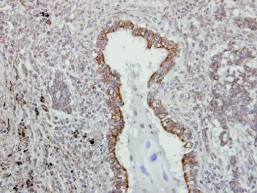 VAPA Rabbit Polyclonal Antibody