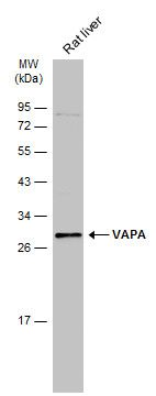 VAPA Rabbit Polyclonal Antibody
