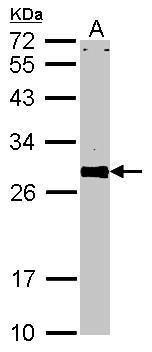 VAPA Rabbit Polyclonal Antibody