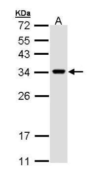 VAPA Rabbit Polyclonal Antibody