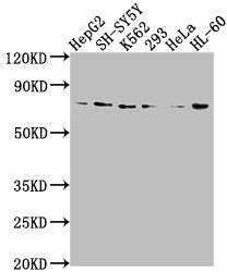 VASN Rabbit Polyclonal Antibody