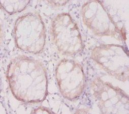 L1CAM Antibody