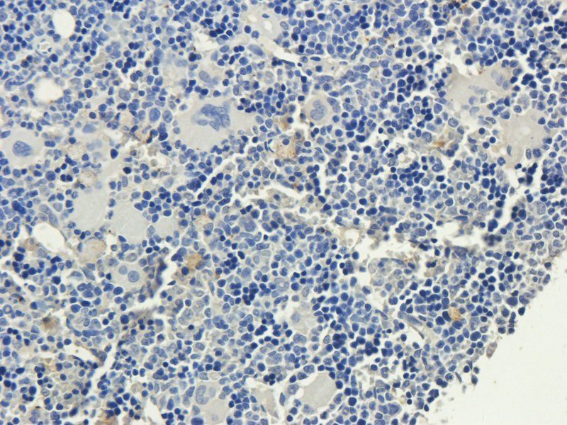 VCAM1 Rabbit Polyclonal Antibody