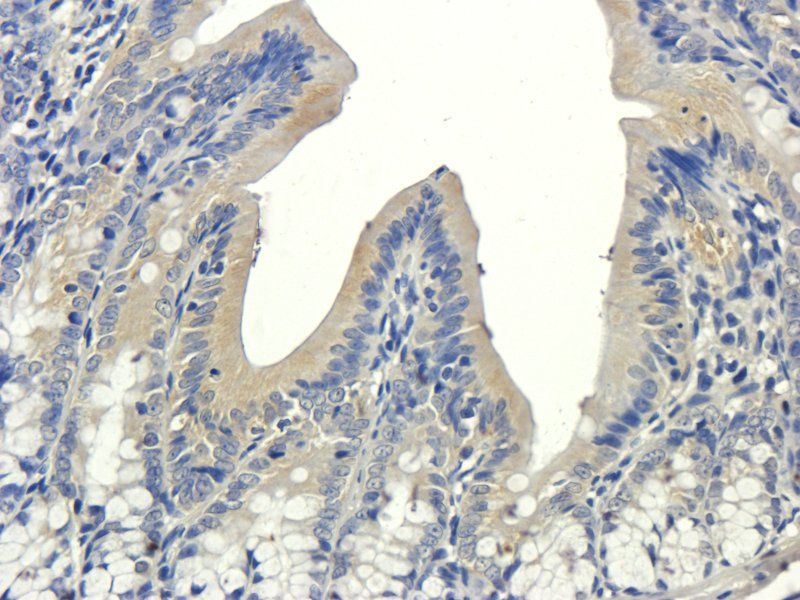 VCAM1 Rabbit Polyclonal Antibody
