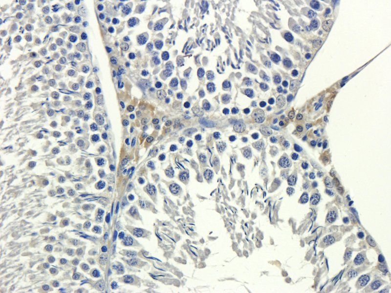 VCAM1 Rabbit Polyclonal Antibody