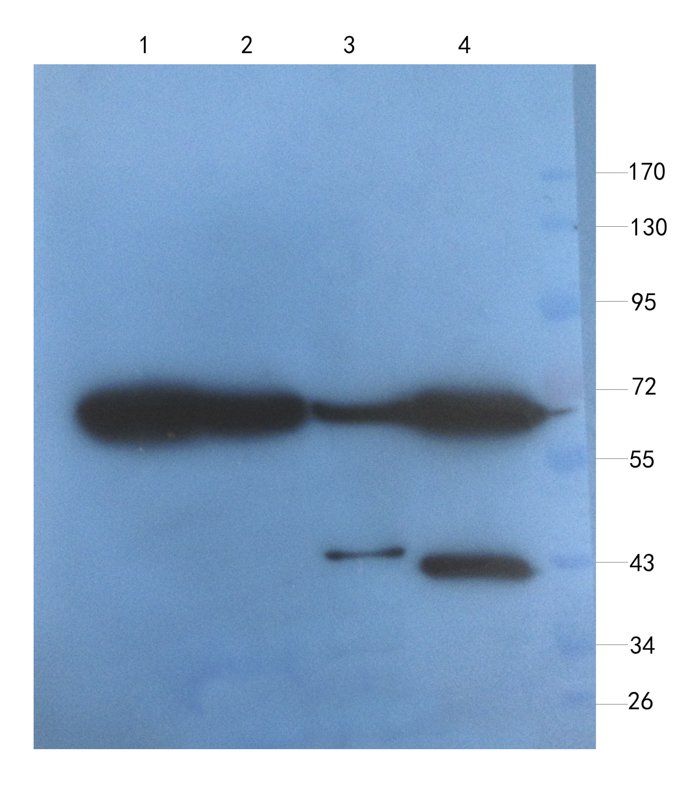 VCAM1 Rabbit Polyclonal Antibody
