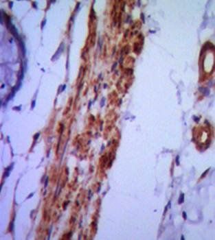 VCAM1 Antibody