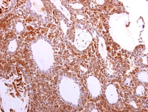 VCP Rabbit Polyclonal Antibody