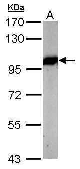 VCP Rabbit Polyclonal Antibody