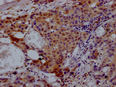 VCP Antibody