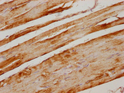 VDAC1 Antibody