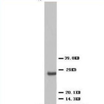 VEGF/VEGFA Rabbit Polyclonal Antibody