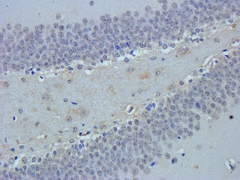 VEGF Rabbit Polyclonal Antibody