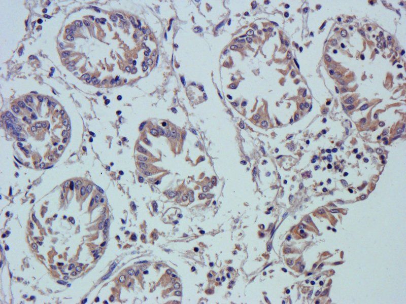 VEGF Rabbit Polyclonal Antibody