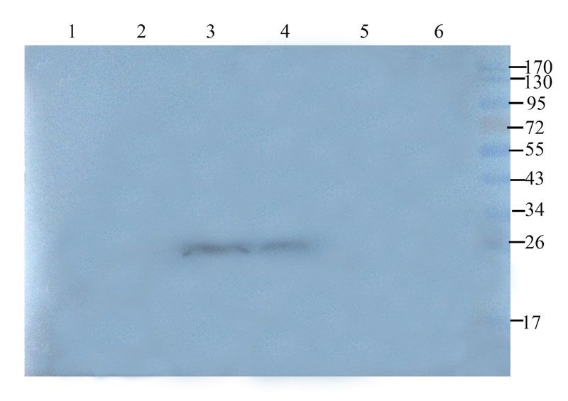 VEGF Rabbit Polyclonal Antibody