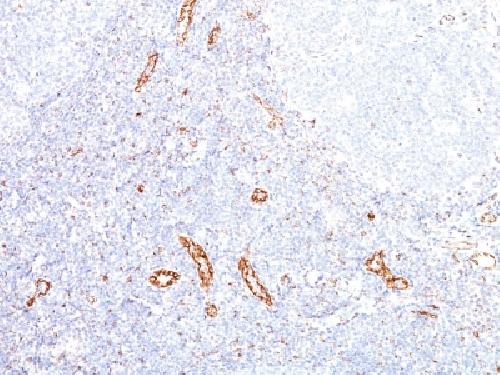 VEGFA Antibody