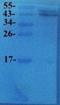 VEGF Rabbit Polyclonal Antibody