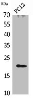 VEGFB Antibody