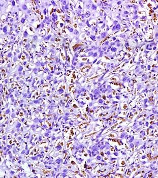 VEGFR2 Rabbit Polyclonal Antibody