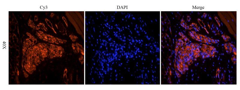 VEGFR2 Rabbit Polyclonal Antibody