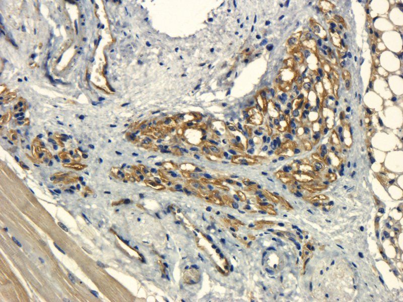 VEGFR2 Rabbit Polyclonal Antibody