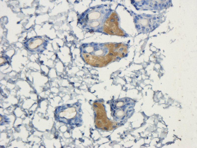 VEGFR3 Rabbit Polyclonal Antibody
