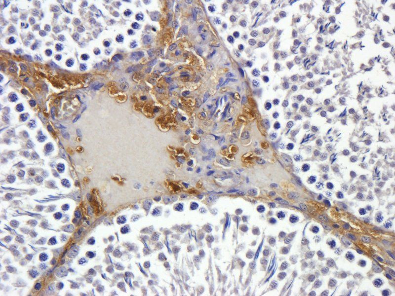 VEGFR3 Rabbit Polyclonal Antibody