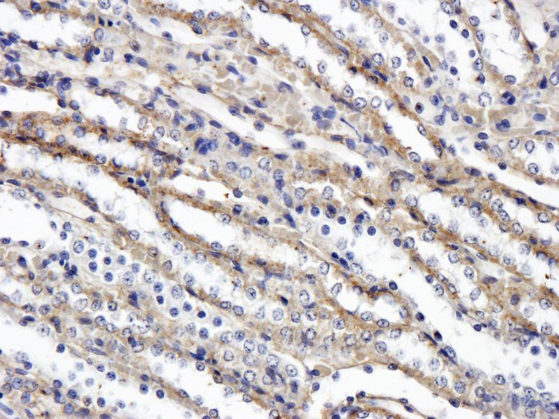 VEGFR3 Rabbit Polyclonal Antibody