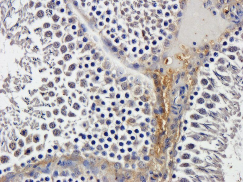 VEGFR3 Rabbit Polyclonal Antibody