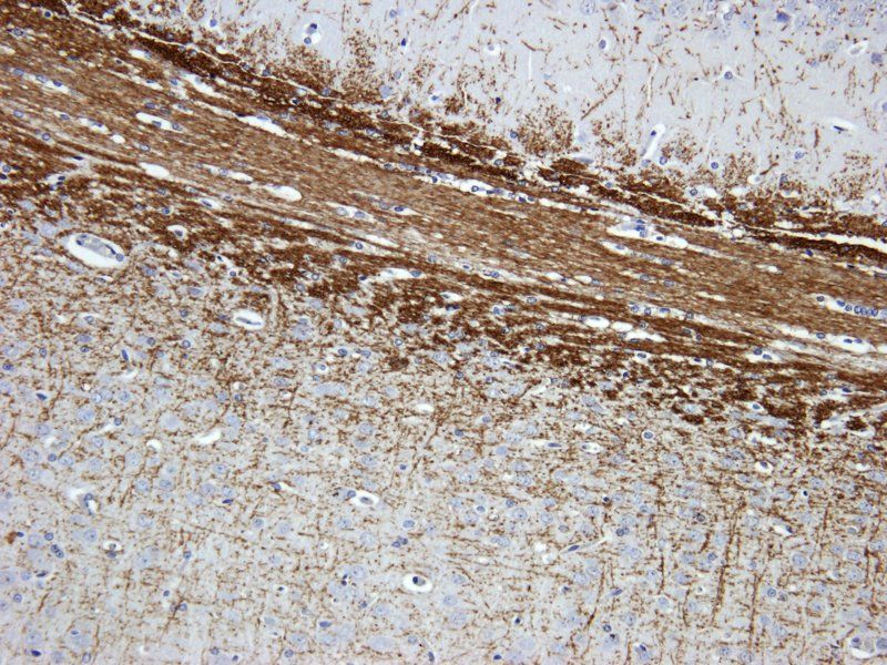 VEGFR3 Rabbit Polyclonal Antibody