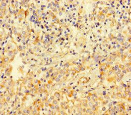 VIM Antibody