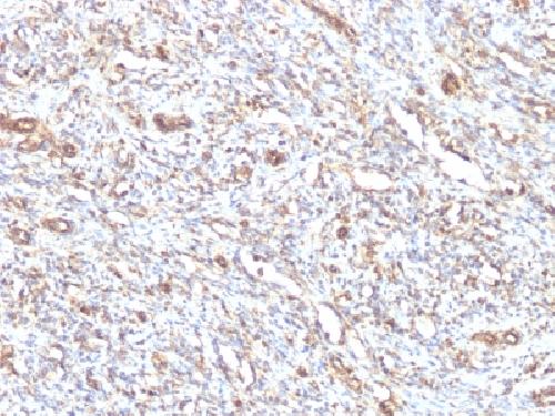 VIM Antibody