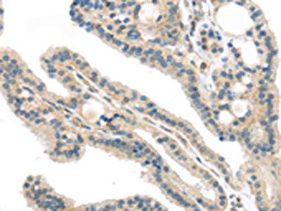 VPS26A Antibody