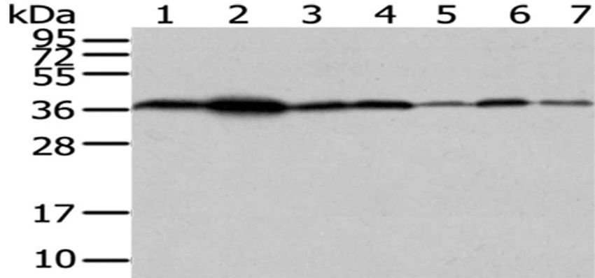 VPS26A Antibody