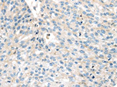 VPS26A Antibody