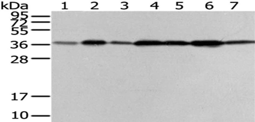 VPS26A Antibody
