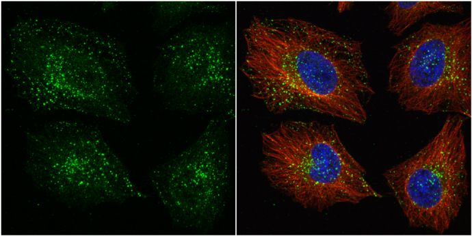 VPS35 Rabbit Polyclonal Antibody