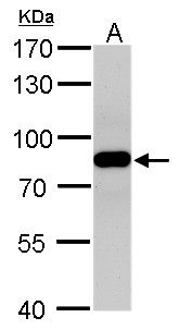 VPS35 Rabbit Polyclonal Antibody
