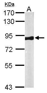 VPS35 Rabbit Polyclonal Antibody