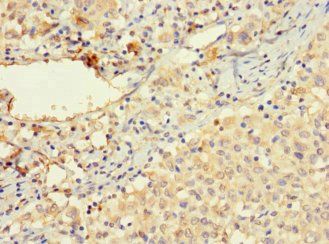 VTN Antibody