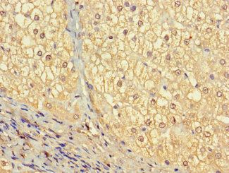 VTN Antibody