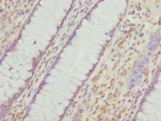 INTS14 Antibody