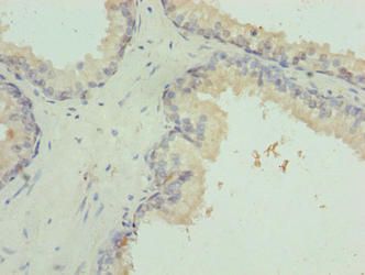 INTS14 Antibody