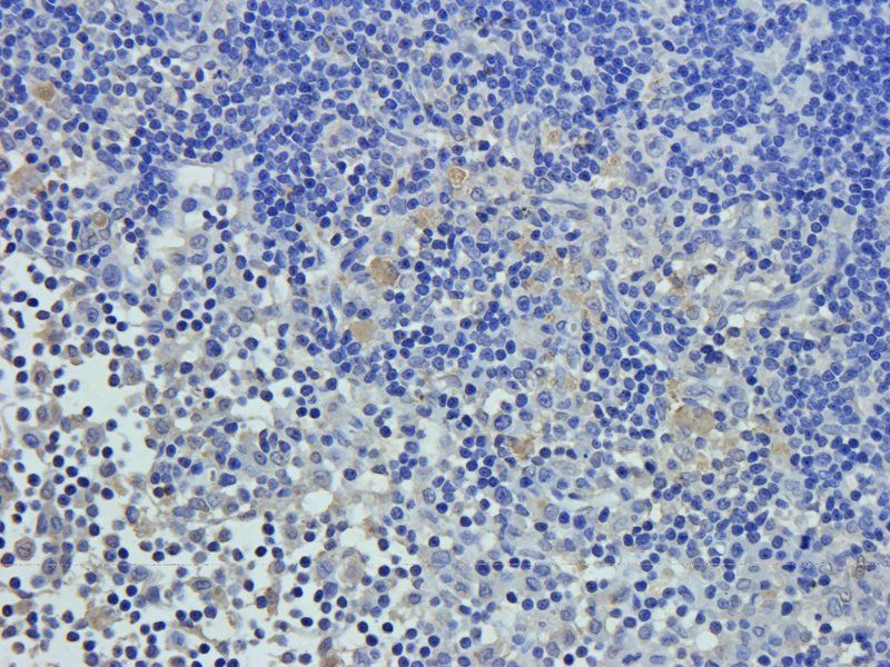 vWF Rabbit Polyclonal Antibody