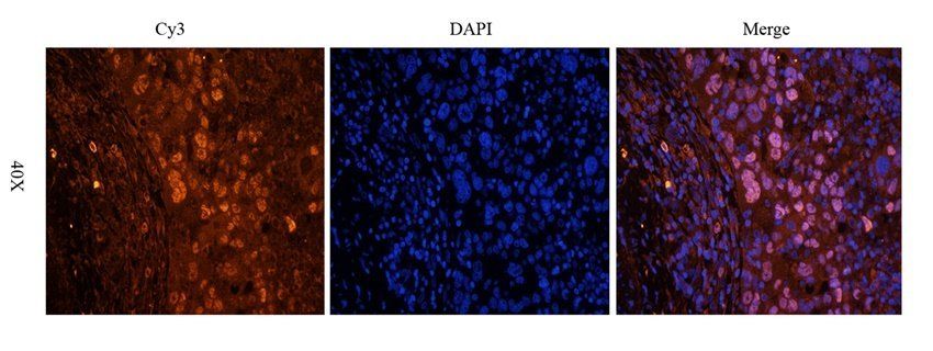 WDFY1 Rabbit Polyclonal Antibody